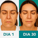 Massageador Facial com Fototerapia Anti-Rugas DermaLift - Reduz rugas e melhora a firmeza da pele em poucos minutos por dia